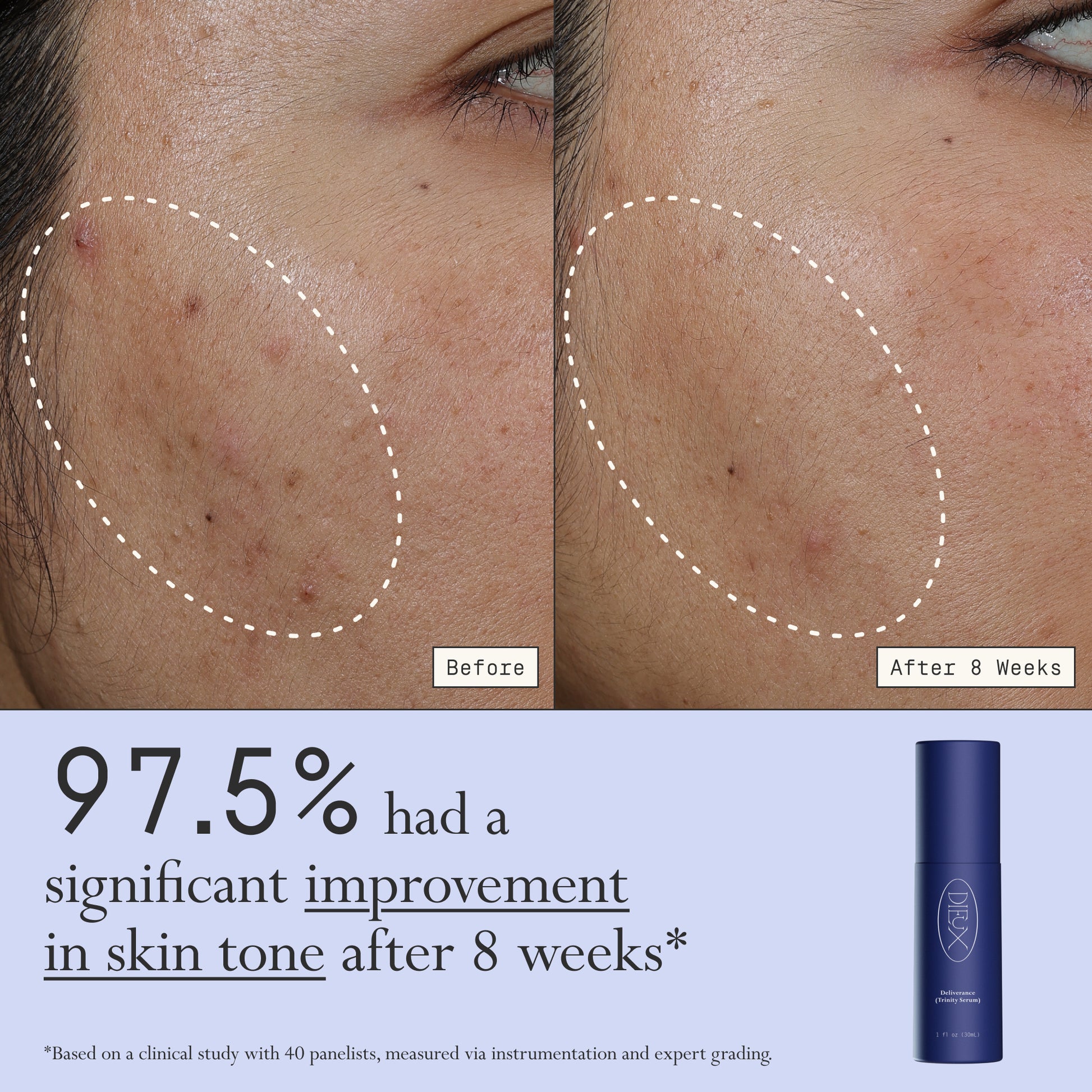 Images of a model before and after 8 weeks of using Dieux Deliverance Serum.
Text: 97.5% had a significant improvement in skin tone after 8 weeks*
*based on a clinical study with 40 panelists, measured via instrumentation and expert grading.