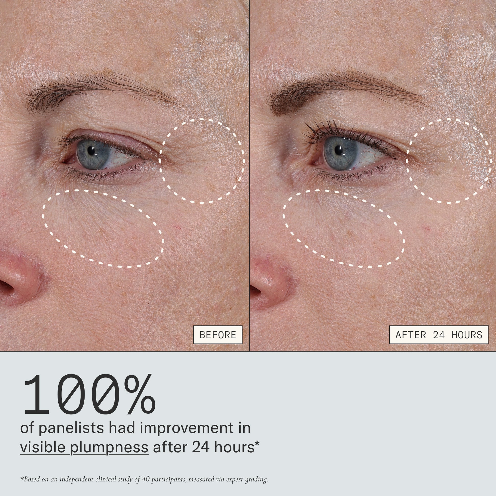 Before and after images from clinical study that shows Dieux Instant Angel Lipid Rich Firming Moisturizer improves visible plumpness after 24 hours