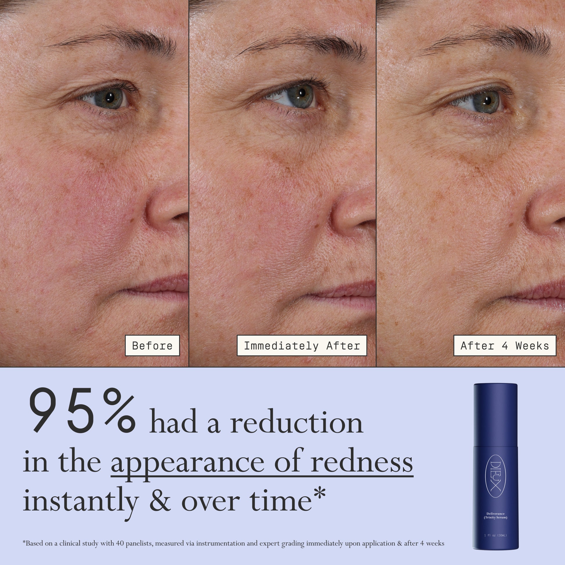 Images of a model before, immediately after, and after 4 weeks of using Dieux Deliverance Serum.
Text: 95% had a reduction in the appearance of redness instantly & over time.
*based on a clinical study with 40 panelists, measured via instrumentation and expert grading immediately upon application and after 4 weeks.