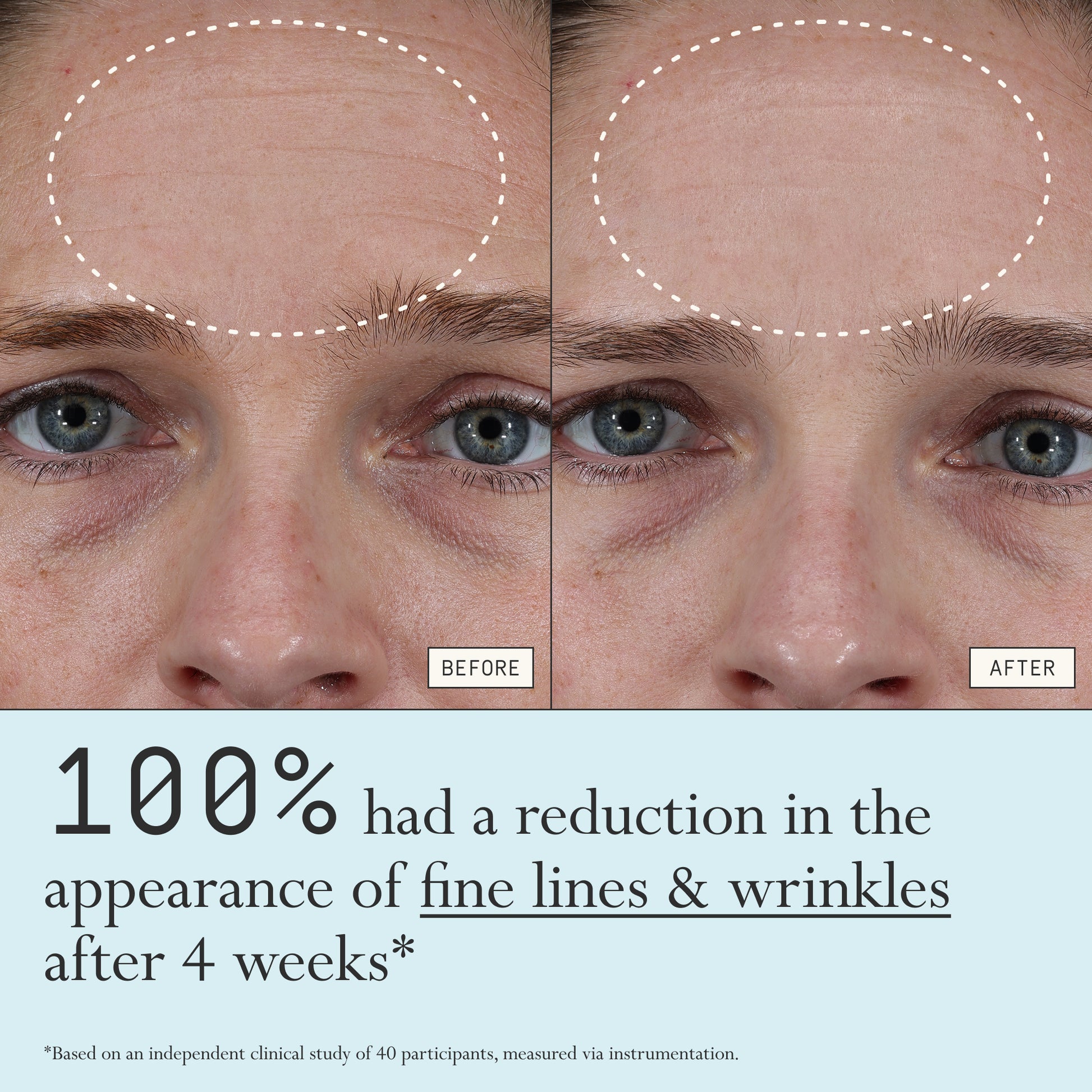 Before and after comparison of fine lines and wrinkles from using Dieux Instant Angel on a person's forehead.
Text: 100% had a reduction in the appearance of fine lines & wrinkles after 4 weeks*
*based on an independent clinical study of 40 participants, measured via instrumentation.