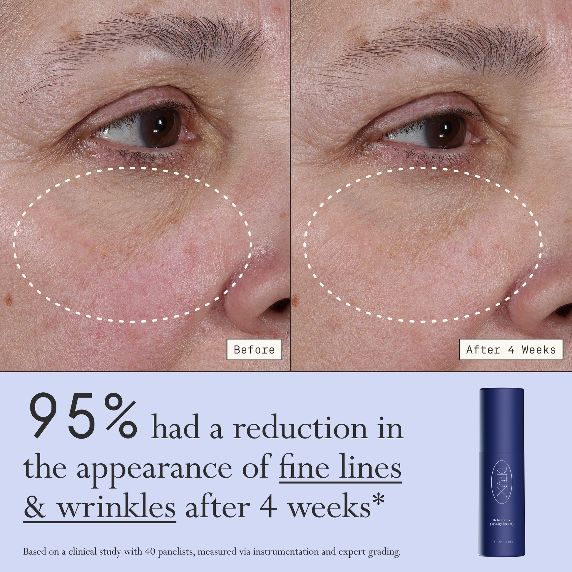 Images of a model before and after 4 weeks of using Dieux Deliverance Serum.
Text: 95% had a reduction in the appearance of fine lines & wrinkles after 4 weeks*
*based on a clinical study with 40 panelists, measured via instrumentation and expert grading.