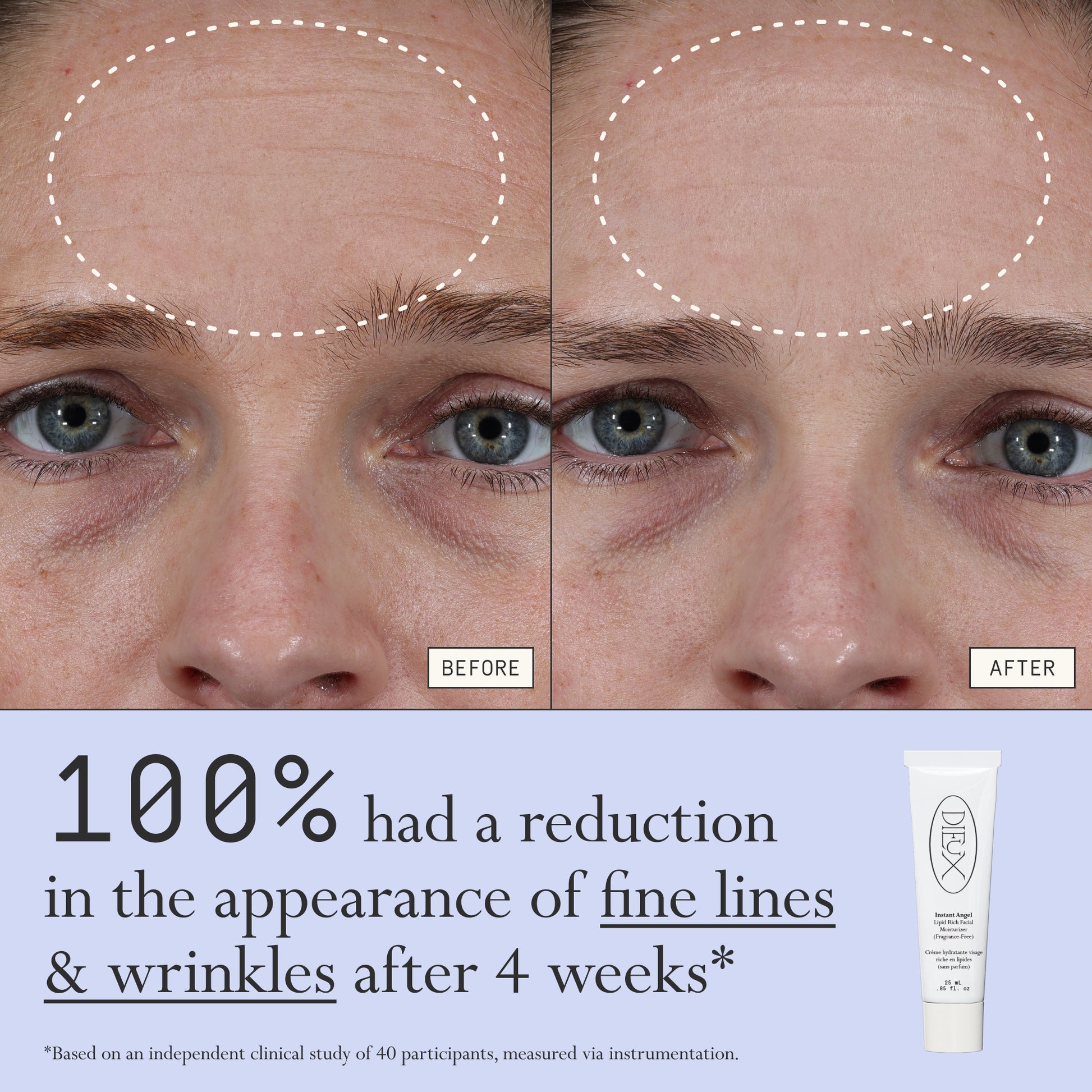 Before and after comparison of fine lines and wrinkles from using Dieux Instant Angel on a person's forehead.
Text: 100% had a reduction in the appearance of fine lines & wrinkles after 4 weeks*
*based on an independent clinical study of 40 participants, measured via instrumentation.