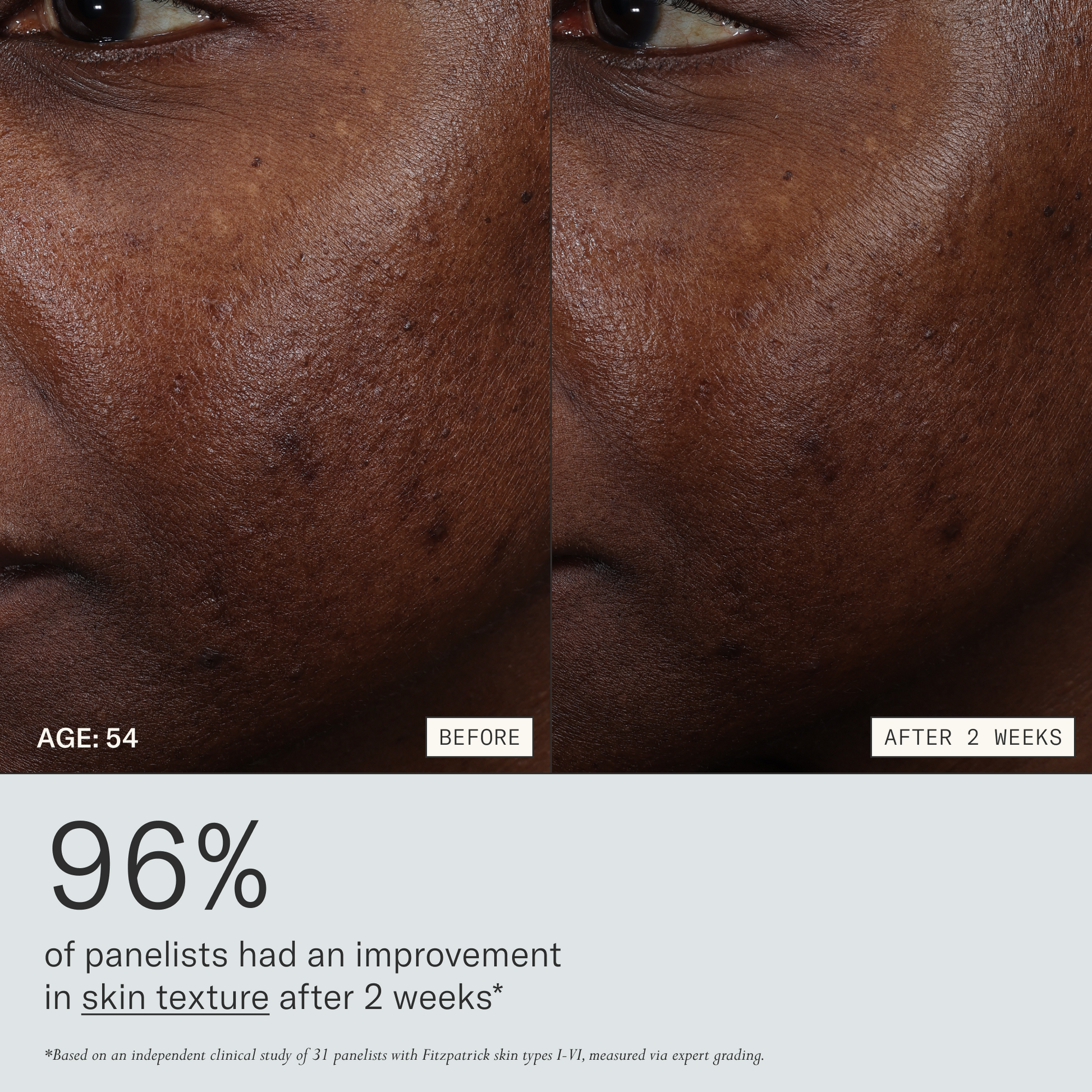 Firm Revival HydroRetinal Firming Serum before and after 2 weeks for a 54 years old participant. 96% of panelists had an improvement in skin texture after 2 weeks. Based on an independent clinical study of 31 panelists with Fitzpatrick skin types I-VI, measured via instrumentation and expert grading.
