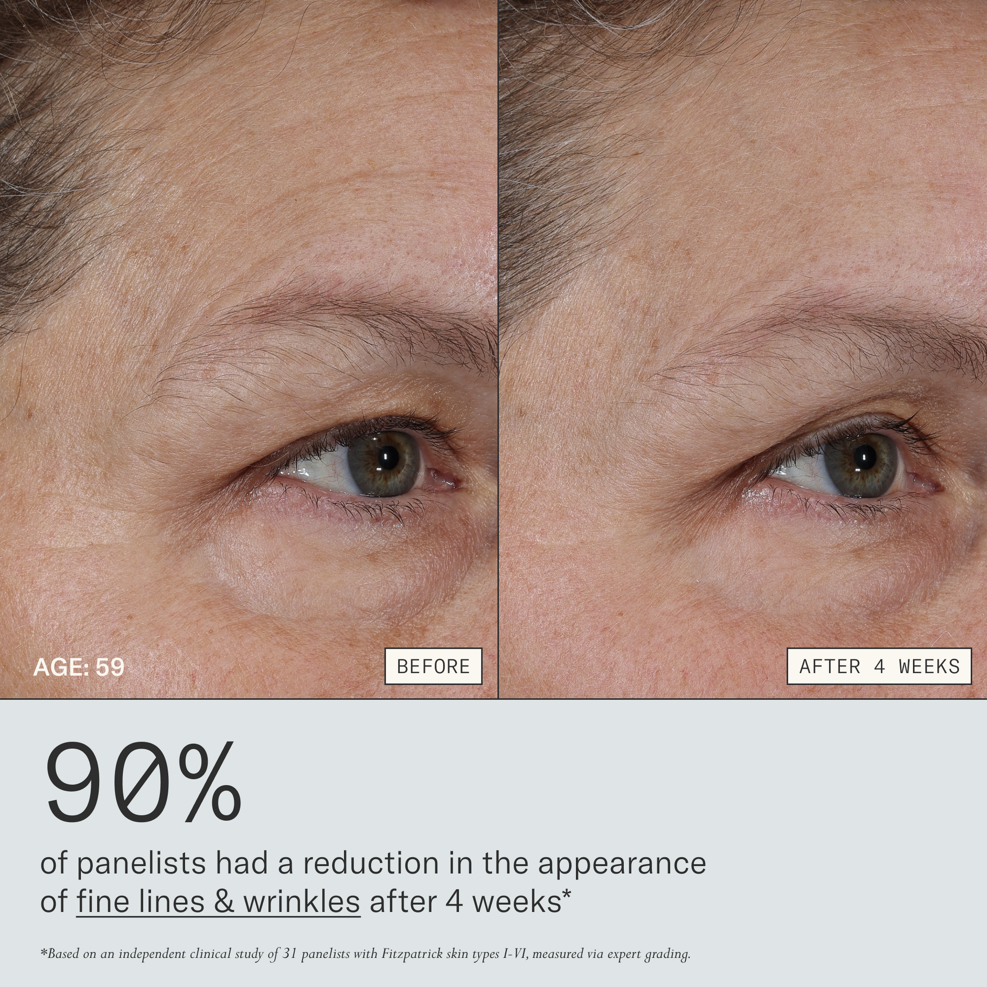 Firm Revival HydroRetinal Firming Serum before and after 4 weeks for a 59 years old participant. 90% of panelists had a reduction in the appearance of fine lines & wrinkles after 4 weeks. Based on an independent clinical study of 31 panelists with Fitzpatrick skin types I-VI, measured via instrumentation and expert grading.