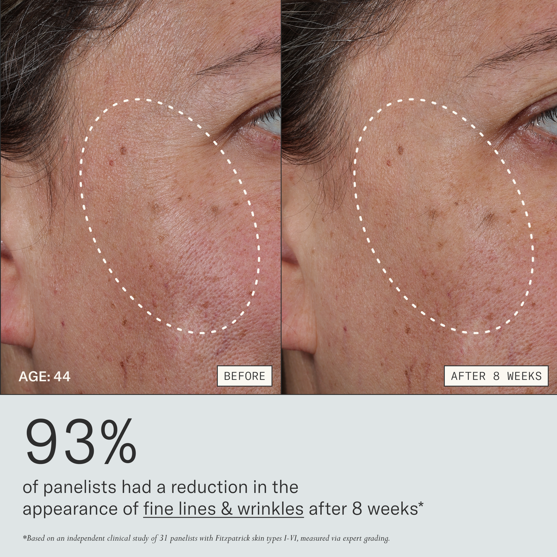 Firm Revival HydroRetinal Firming Serum before and after 8 weeks for a 44 years old participant. 93% of panelists had a reduction in the appearance of fine lines & wrinkles after 8 weeks. Based on an independent clinical study of 31 panelists with Fitzpatrick skin types I-VI, measured via instrumentation and expert grading.