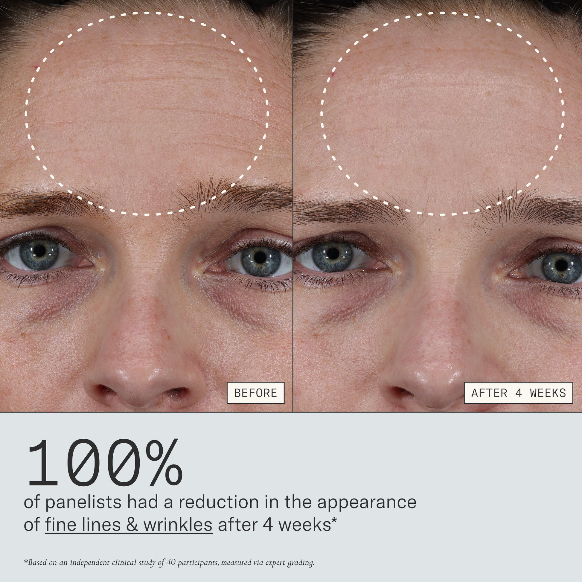 100% of panelists had a reduction in the appearance of fine lines & wrinkles in 4 weeks. Based on an independent clinical study of 40 participants, measured with expert grading.