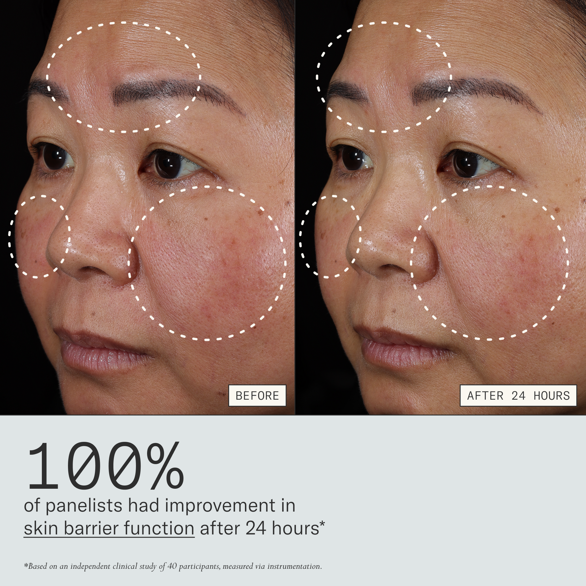 100% of panelists had improvement in skin barrier function after 24 hours. Based on an independent clinical study of 40 participants, measured via instrumentation.