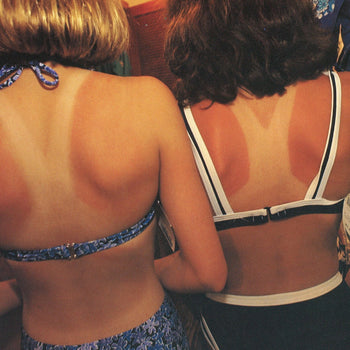 Skin with UV damage