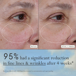 Images of a model before and after 4 weeks of using Dieux Deliverance Serum.

Text: 95% had a significant reduction in fine lines & wrinkles after 4 weeks*

*based on a clinical study with 40 panelists, measured via instrumentation and expert grading.