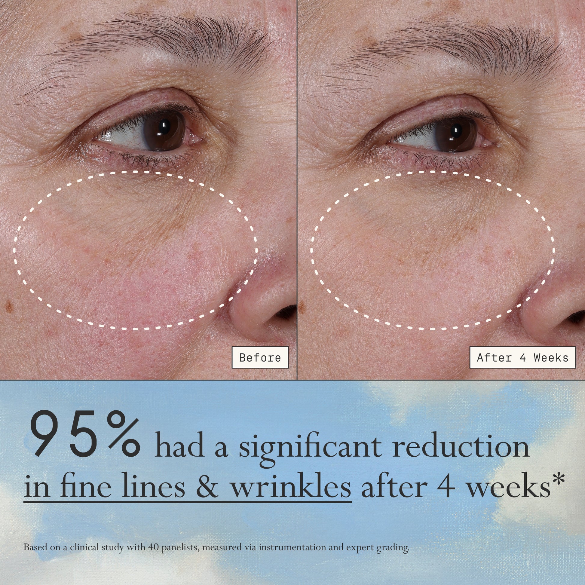 Images of a model before and after 4 weeks of using Dieux Deliverance Serum.

Text: 95% had a significant reduction in fine lines & wrinkles after 4 weeks*

*based on a clinical study with 40 panelists, measured via instrumentation and expert grading.
