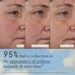 Images of a model before, immediately after, and after 4 weeks of using Dieux Deliverance Serum.

Text: 95% had a significant reduction in the appearance of redness instantly & over time*

*based on a clinical study with 40 panelists, measured via instrumentation and expert grading immediately upon application and after 4 weeks.
