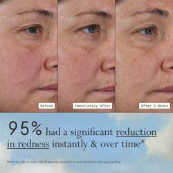 Images of a model before, immediately after, and after 4 weeks of using Dieux Deliverance Serum.

Text: 95% had a significant reduction in redness instantly & over time*

*based on a clinical study with 40 panelists, measured via instrumentation and expert grading.
