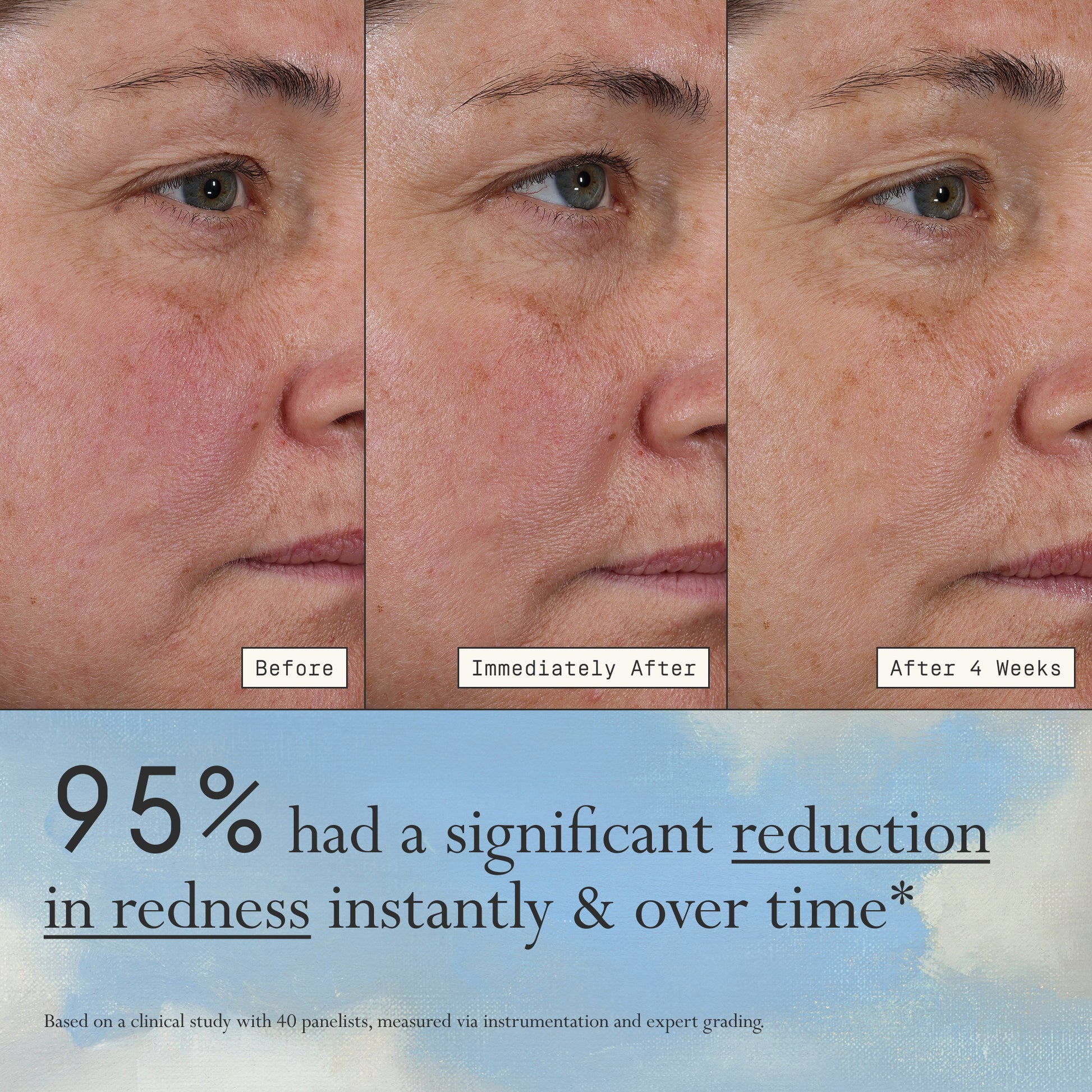 Images of a model before, immediately after, and after 4 weeks of using Dieux Deliverance Serum.

Text: 95% had a significant reduction in redness instantly & over time*

*based on a clinical study with 40 panelists, measured via instrumentation and expert grading.
