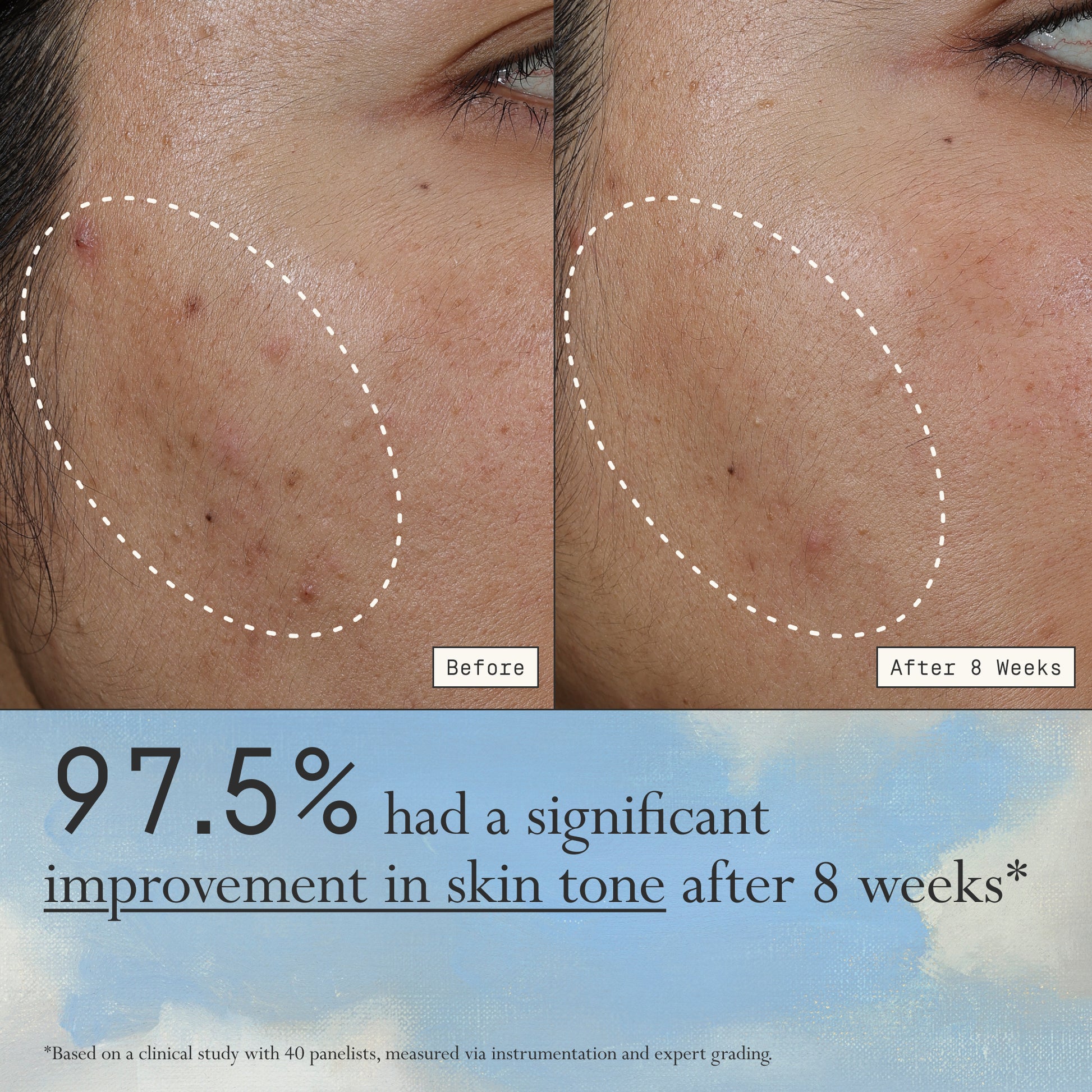 Images of a model before and after 8 weeks of using Dieux Deliverance Serum.

Text: 97.5% had a significant improvement in skin tone after 8 weeks*

*based on a clinical study with 40 panelists, measured via instrumentation and expert grading.