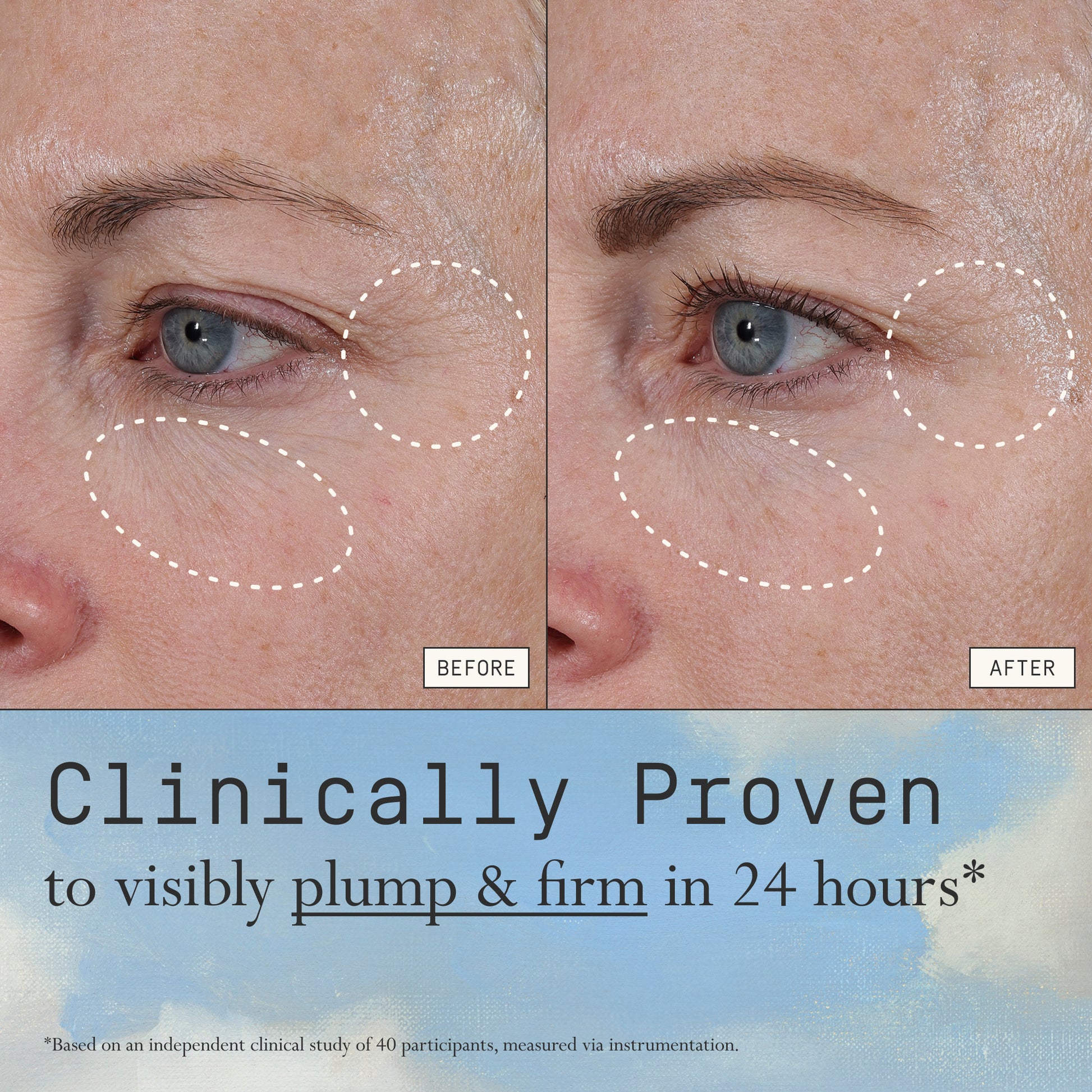 Before and after comparison of fine lines and wrinkles from using Dieux Instant Angel on a person's eye area.

Text: Clinically Proven to visibly plump & firm in 4 hours*

*based on an independent clinical study of 40 participants, measured via instrumentation