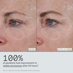 Before and after images from clinical study that shows Dieux Instant Angel Lipid Rich Firming Moisturizer improves visible plumpness after 24 hours
