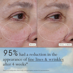 Images of a model before and after 4 weeks of using Dieux Deliverance Serum.

Text: 95% had a reduction in the appearance of fine lines & wrinkles after 4 weeks*

*based on a clinical study with 40 panelists, measured via instrumentation.