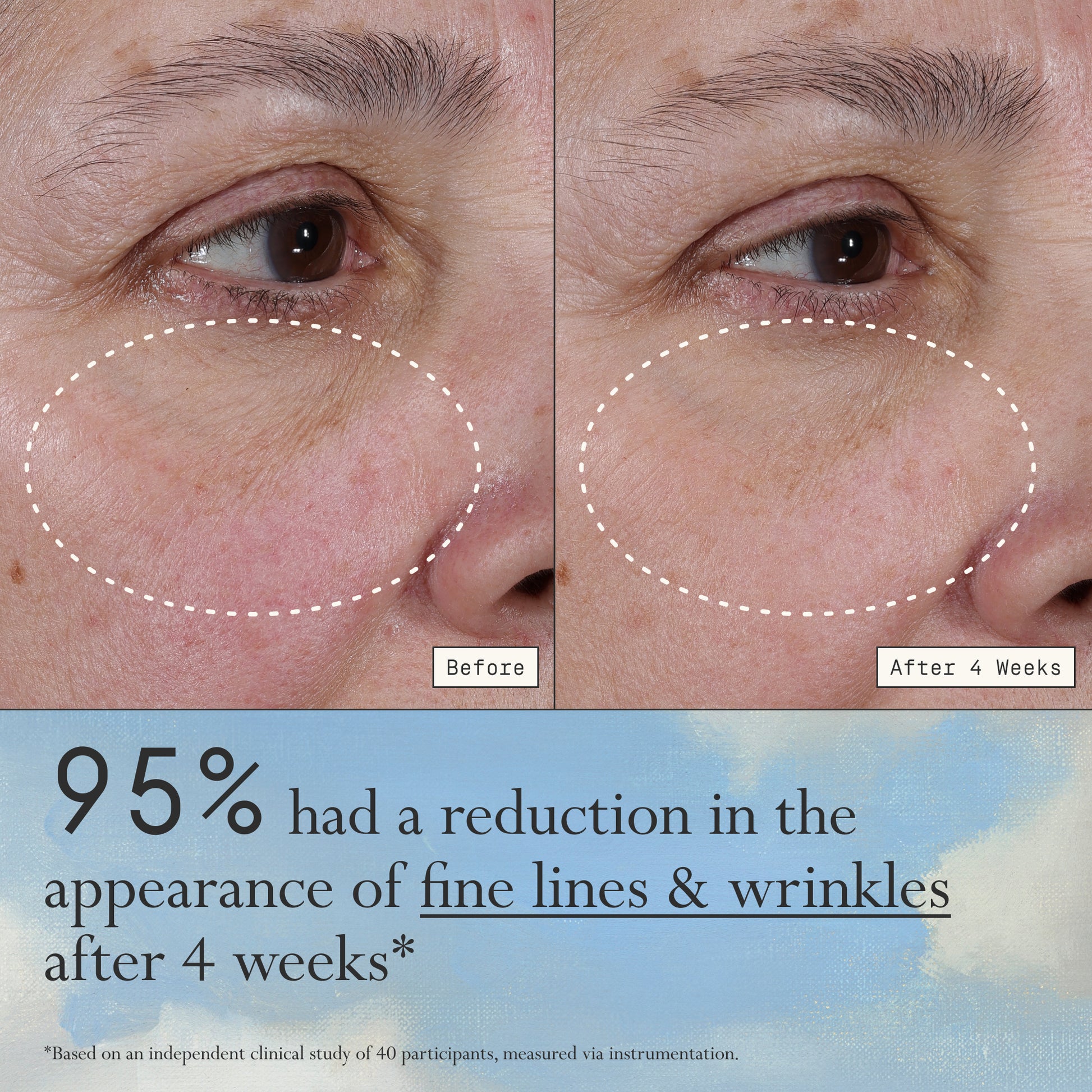 Images of a model before and after 4 weeks of using Dieux Deliverance Serum.

Text: 95% had a reduction in the appearance of fine lines & wrinkles after 4 weeks*

*based on a clinical study with 40 panelists, measured via instrumentation.