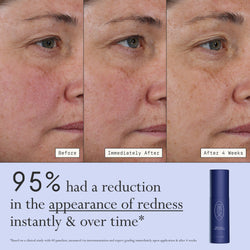 Images of a model before, immediately after, and after 4 weeks of using Dieux Deliverance Serum.

Text: 95% had a reduction in the appearance of redness instantly & over time.

*based on a clinical study with 40 panelists, measured via instrumentation and expert grading immediately upon application and after 4 weeks. 