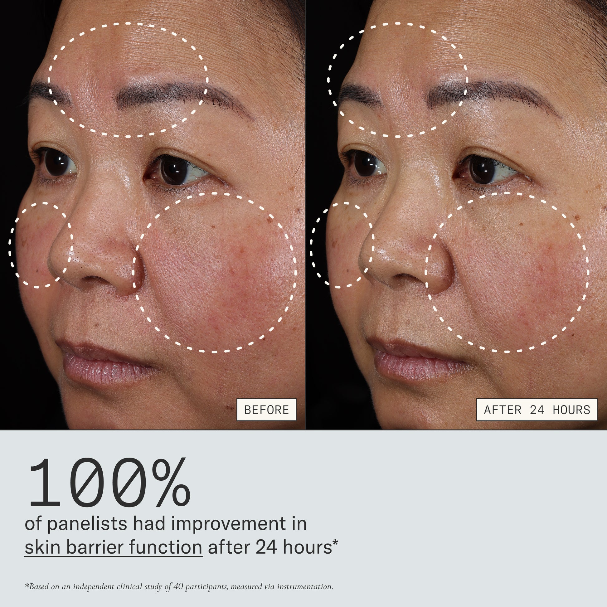 Before and after images from clinical study that shows Dieux Instant Angel Lipid Rich Firming Moisturizer improves skin barrier function after 24 hours