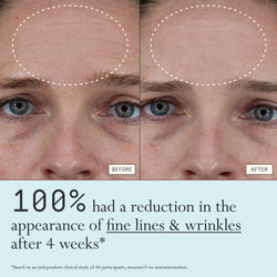 Before and after comparison of fine lines and wrinkles from using Dieux Instant Angel on a person's forehead.

Text: 100% had a reduction in the appearance of fine lines & wrinkles after 4 weeks*

*based on an independent clinical study of 40 participants, measured via instrumentation.