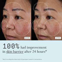 Before and after comparison of redness from using Dieux Instant Angel on a person's face.

Text: 100% had improvement in skin barrier after 24 hours*

*based on an independent clinical study of 40 participants, measured via instrumentation.