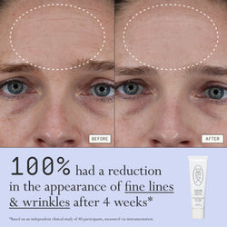 Before and after comparison of fine lines and wrinkles from using Dieux Instant Angel on a person's forehead.

Text: 100% had a reduction in the appearance of fine lines & wrinkles after 4 weeks*

*based on an independent clinical study of 40 participants, measured via instrumentation.