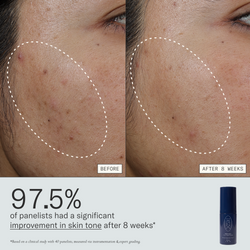 97.5% of panelists had a significant improvement in skin tone after 8 weeks of using Deliverance Serum. Based on a clinical study with 40 panelists, measured via instrumentation & expert grading.