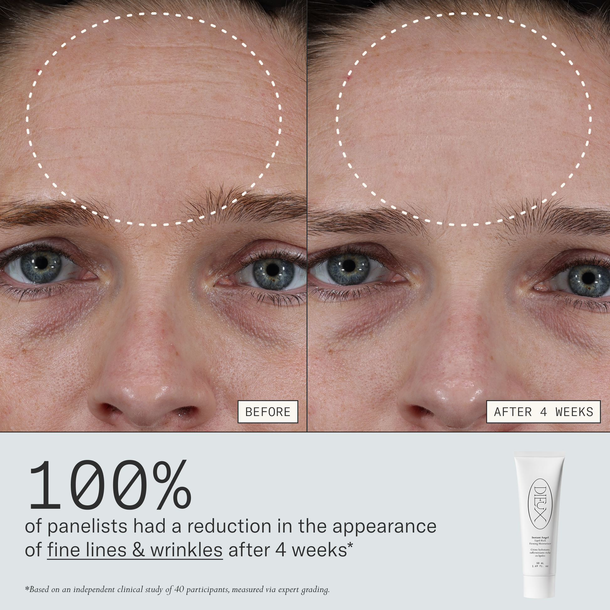 100% of panelists had a reduction in the appearance of fine lines & wrinkles after 4 weeks of using Instant Angel Firming Moisturizer. Based on an independent clinical study of 40 participants, measured via expert grading.