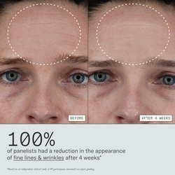 100% of panelists had a reduction in the appearance of fine lines & wrinkles in 4 weeks. Based on an independent clinical study of 40 participants, measured with expert grading.