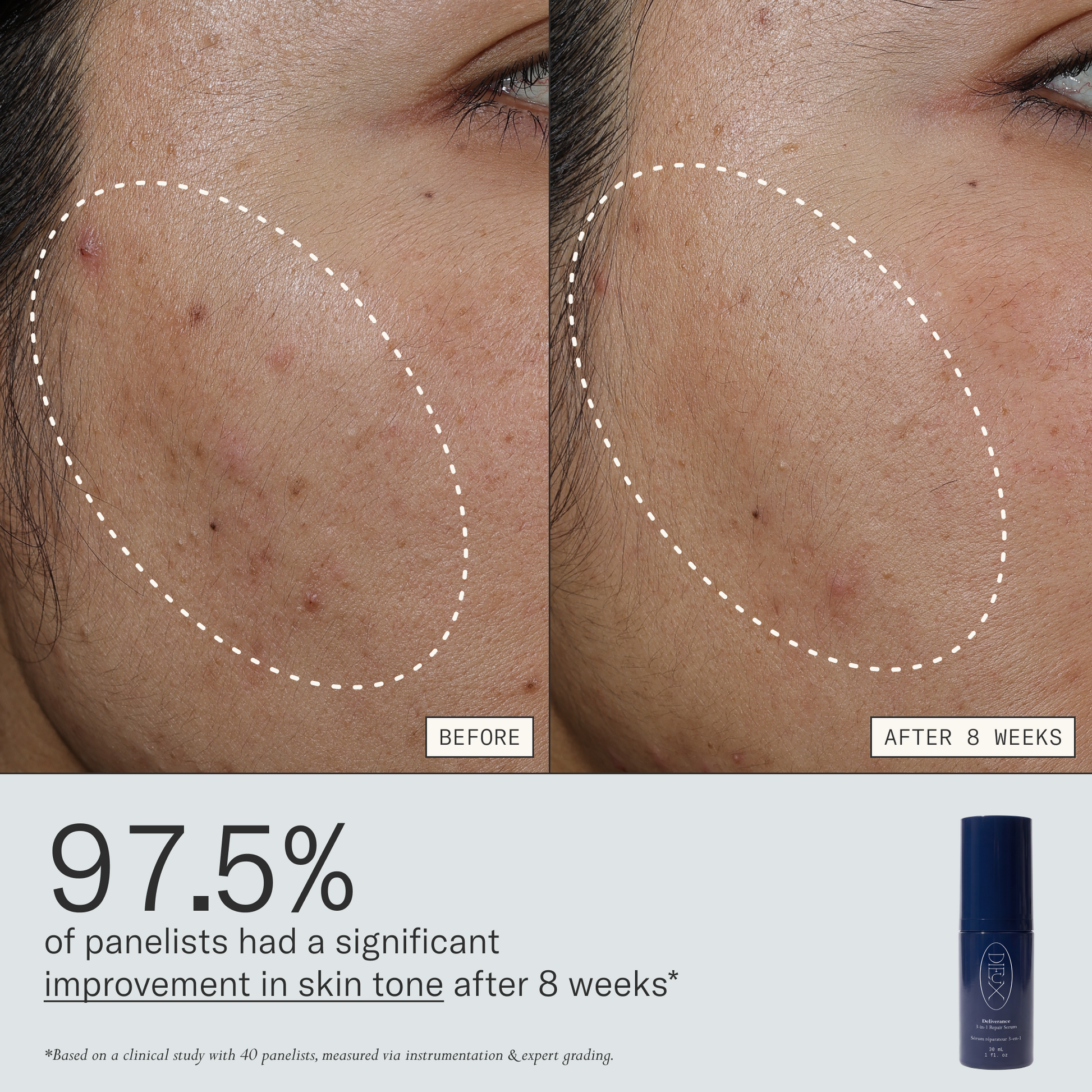 97.5% of panelists had a significant improvement in skin tone after 8 weeks of using Deliverance Serum. Based on a clinical study with 40 panelists, measured via instrumentation & expert grading.